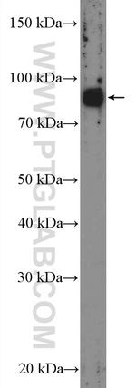 GLE1 Antibody in Western Blot (WB)