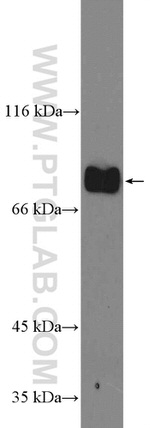 GLE1 Antibody in Western Blot (WB)