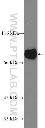 GLE1 Antibody in Western Blot (WB)