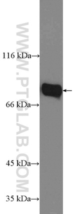 GLE1 Antibody in Western Blot (WB)
