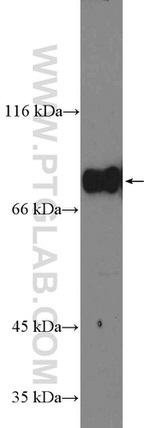 GLE1 Antibody in Western Blot (WB)
