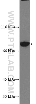 GLE1 Antibody in Western Blot (WB)