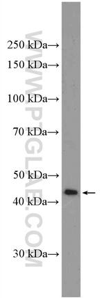Nesprin 4 Antibody in Western Blot (WB)