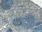 SPC25 Antibody in Immunohistochemistry (Paraffin) (IHC (P))