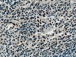 SPC25 Antibody in Immunohistochemistry (Paraffin) (IHC (P))