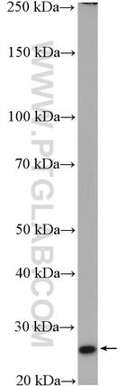 SPC25 Antibody in Western Blot (WB)