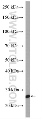 SPC25 Antibody in Western Blot (WB)