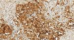 Plakophilin 2 Antibody in Immunohistochemistry (Paraffin) (IHC (P))