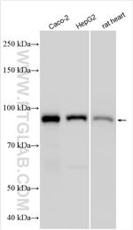 Plakophilin 2 Antibody in Western Blot (WB)
