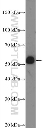 HOXA10 Antibody in Western Blot (WB)