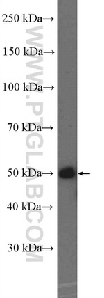 HOXA10 Antibody in Western Blot (WB)