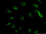FAM131B Antibody in Immunocytochemistry (ICC/IF)