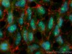 AMBN Antibody in Immunocytochemistry (ICC/IF)