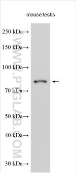 Anosmin-1 Antibody in Western Blot (WB)