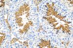 FAM181A Antibody in Immunohistochemistry (Paraffin) (IHC (P))