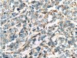 C13orf1 Antibody in Immunohistochemistry (Paraffin) (IHC (P))