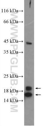 C13orf1 Antibody in Western Blot (WB)