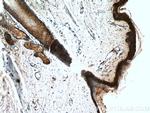 LCE2B Antibody in Immunohistochemistry (Paraffin) (IHC (P))