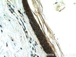LCE2B Antibody in Immunohistochemistry (Paraffin) (IHC (P))