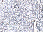 Vinculin Antibody in Immunohistochemistry (Paraffin) (IHC (P))