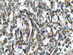 Vinculin Antibody in Immunohistochemistry (Paraffin) (IHC (P))
