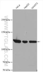 Vinculin Antibody in Western Blot (WB)