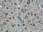 Parvalbumin Antibody in Immunohistochemistry (Paraffin) (IHC (P))