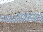 Parvalbumin Antibody in Immunohistochemistry (Paraffin) (IHC (P))