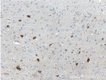 Parvalbumin Antibody in Immunohistochemistry (Paraffin) (IHC (P))