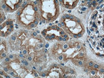 CLTC Antibody in Immunohistochemistry (Paraffin) (IHC (P))