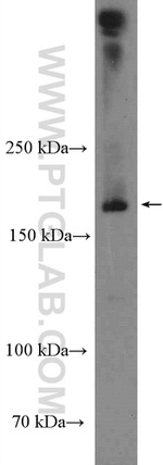 CLTC Antibody in Western Blot (WB)