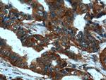CLTC Antibody in Immunohistochemistry (Paraffin) (IHC (P))