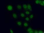 PPM1D Antibody in Immunocytochemistry (ICC/IF)