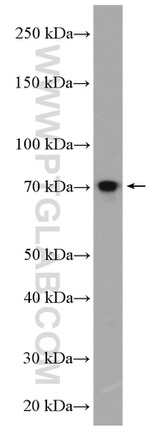 PPM1D Antibody in Western Blot (WB)