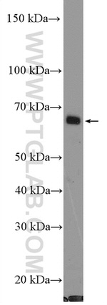 PPM1D Antibody in Western Blot (WB)