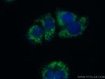 PMPCA Antibody in Immunocytochemistry (ICC/IF)