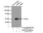 PMPCA Antibody in Immunoprecipitation (IP)