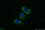 SLC39A14/ZIP-14 Antibody in Immunocytochemistry (ICC/IF)