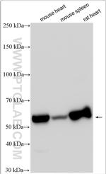 SLC39A14/ZIP-14 Antibody in Western Blot (WB)