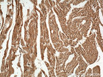CPT2 Antibody in Immunohistochemistry (Paraffin) (IHC (P))