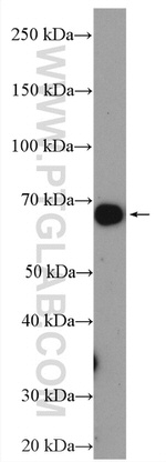 CPT2 Antibody in Western Blot (WB)