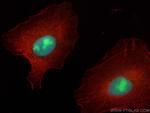 ECT2 Antibody in Immunocytochemistry (ICC/IF)