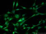 ECT2 Antibody in Immunocytochemistry (ICC/IF)