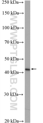 SERPINB3 Antibody in Western Blot (WB)
