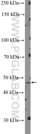SERPINB3 Antibody in Western Blot (WB)