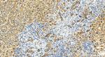 LIMCH1 Antibody in Immunohistochemistry (Paraffin) (IHC (P))