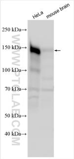 LIMCH1 Antibody in Western Blot (WB)