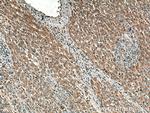 ATG101 Antibody in Immunohistochemistry (Paraffin) (IHC (P))