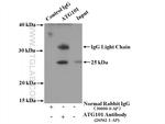 ATG101 Antibody in Immunoprecipitation (IP)