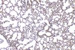 ABCA1 Antibody in Immunohistochemistry (Paraffin) (IHC (P))